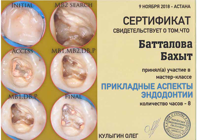 Удаление зуба в Dent-Lux в Казахстане, фото 136